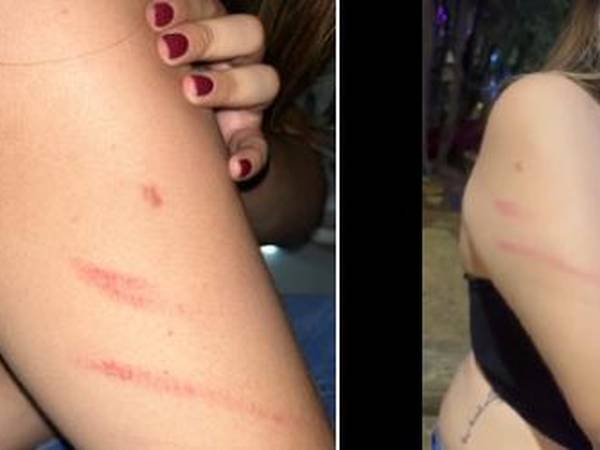 Joven denunció que fue maltratada y golpeada en reconocida discoteca de Provenza en Medellín